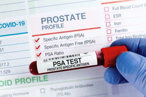 Patient advocate: The gland guys don’t want to talk about