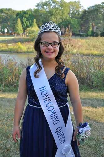Teen with Down syndrome crowned Homecoming Queen by Coronado students
