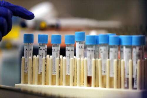 Schaumburg man charged in $66 million COVID test fraud