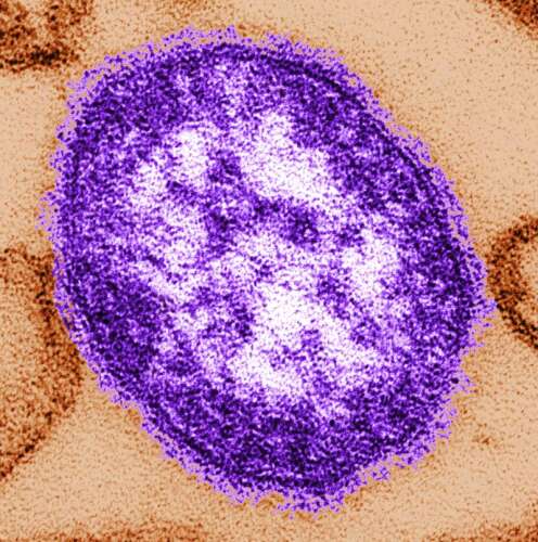 The Cook County Department of Public Health is warning of possible measles exposures in Mount Prospect and other parts of the Northwest suburbs. The virus can remain in the air for up to two hours aft...
